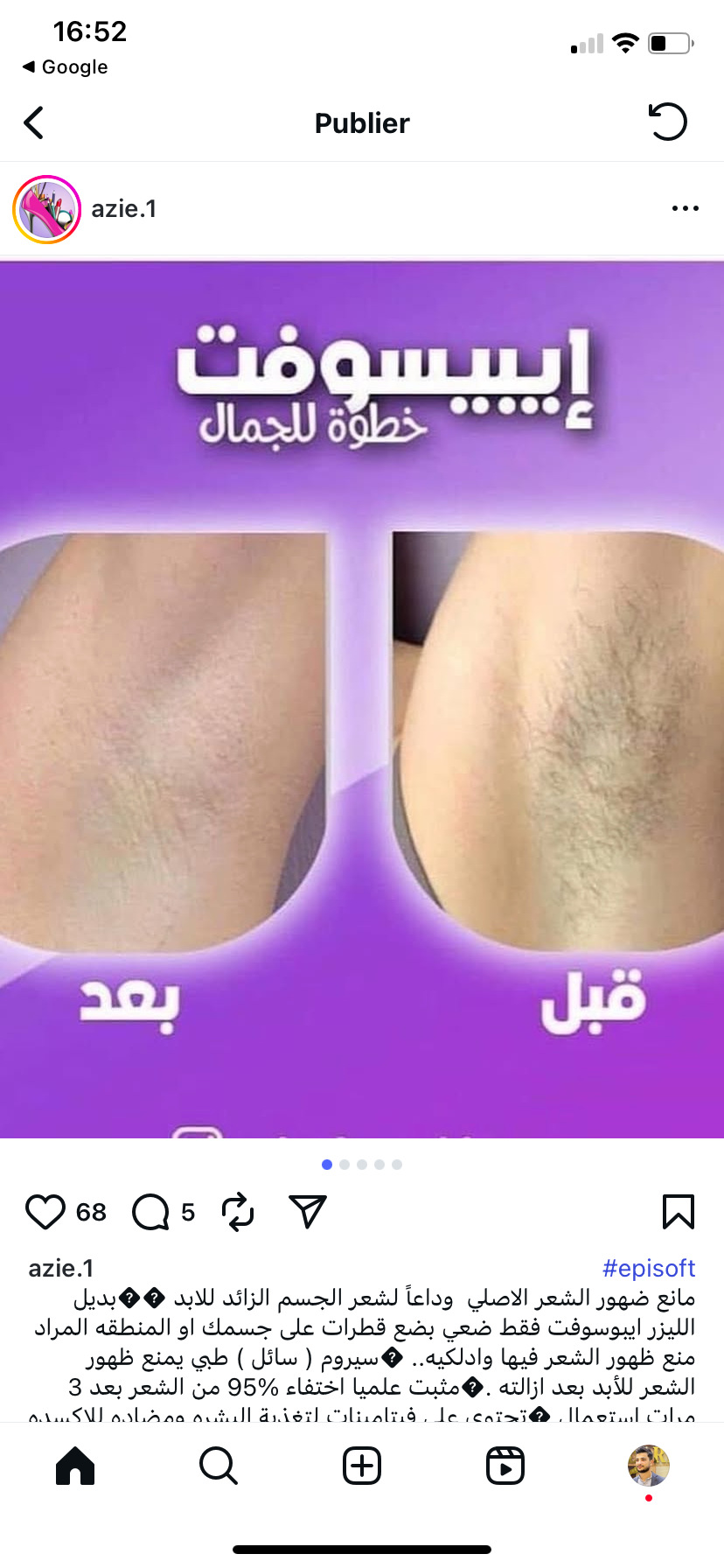 Episoft مانع ضهور الشعر